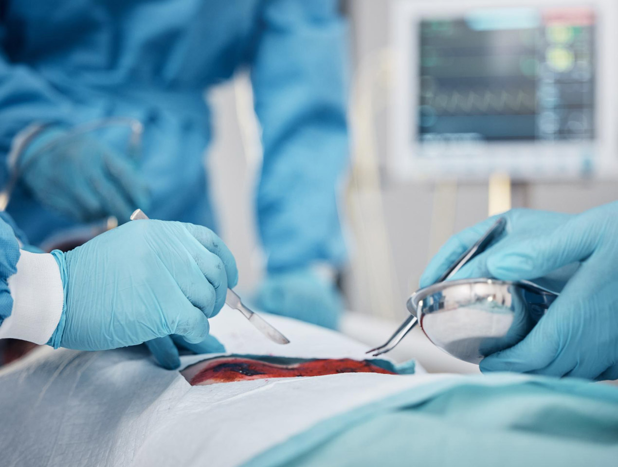 Consulta de Cirugías Ambulatorias